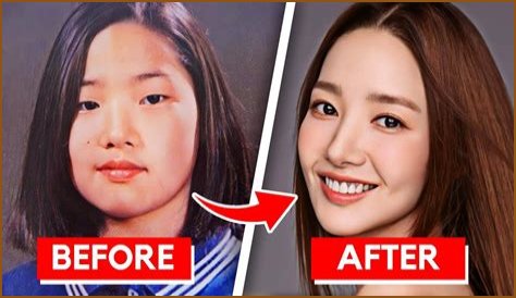 Kim Lee Before Plastic Surgery Examined!